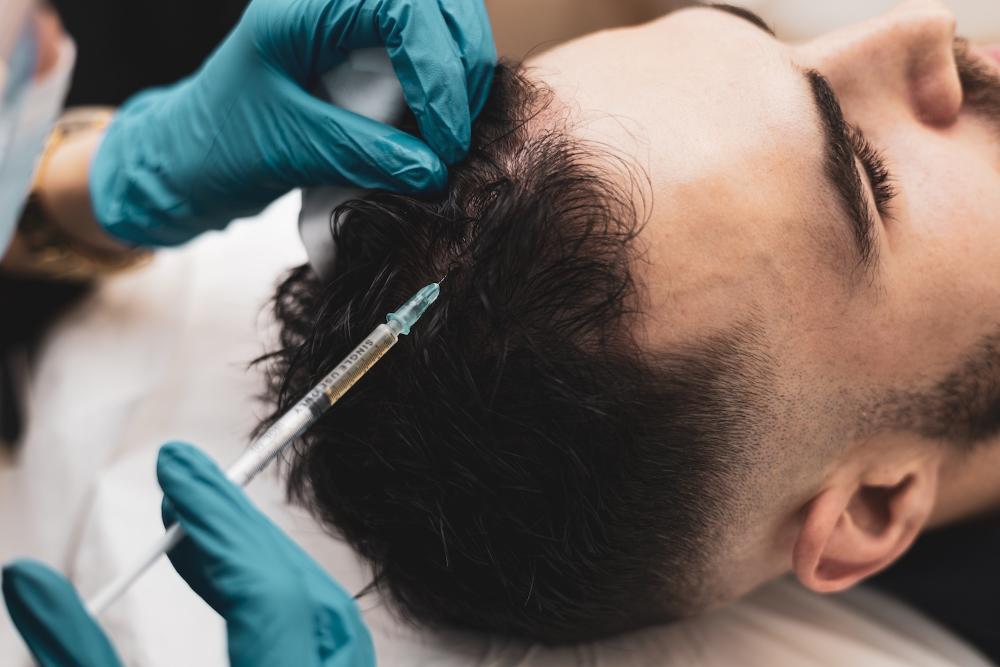 Provider administering a scalp injection during hair restoration treatment